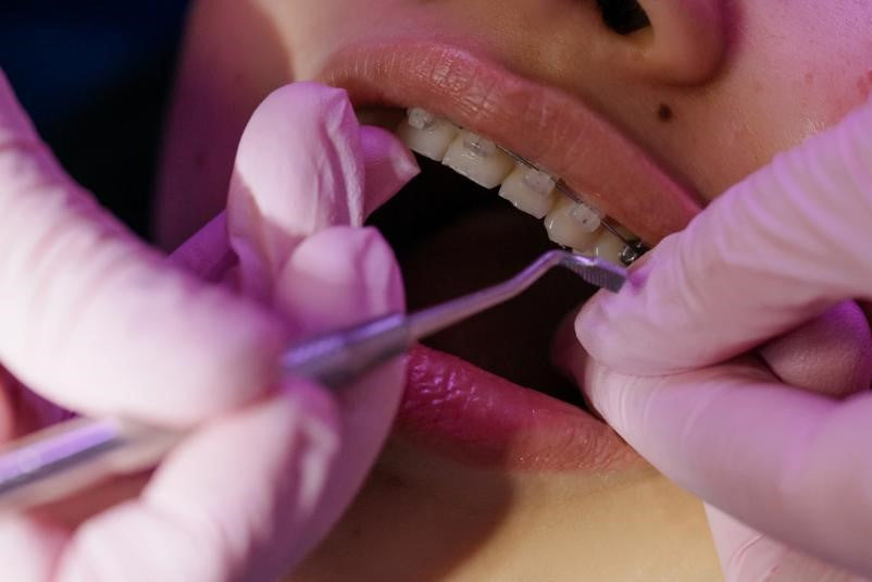 Patient having teeth and braces checked