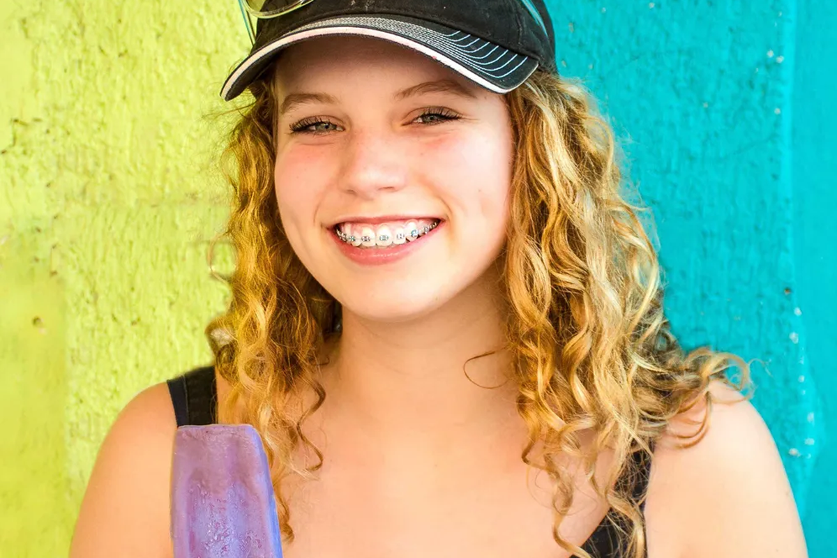 Oral care tips to prevent stained teeth during braces treatment