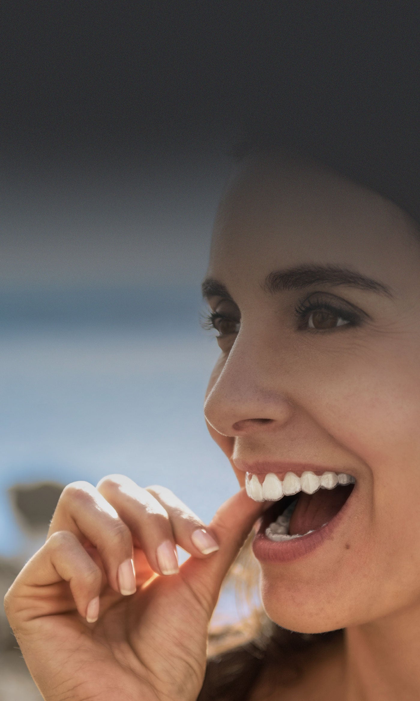 Patient wearing Invisalign aligners