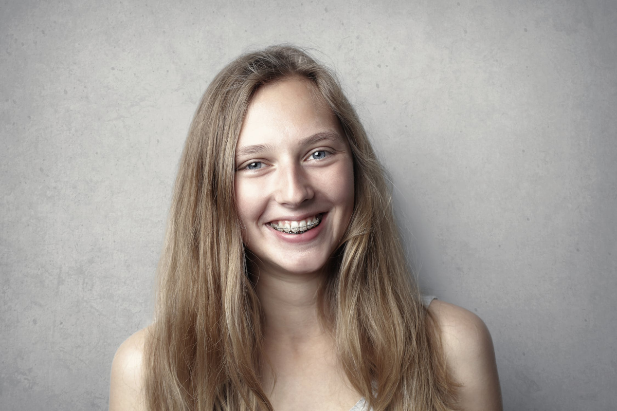 How to Use Interdental Brushes for Clean Braces