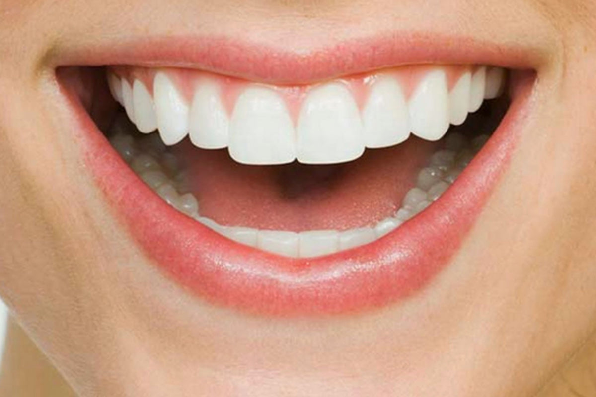 Why more UK adults are choosing to straighten their teeth
