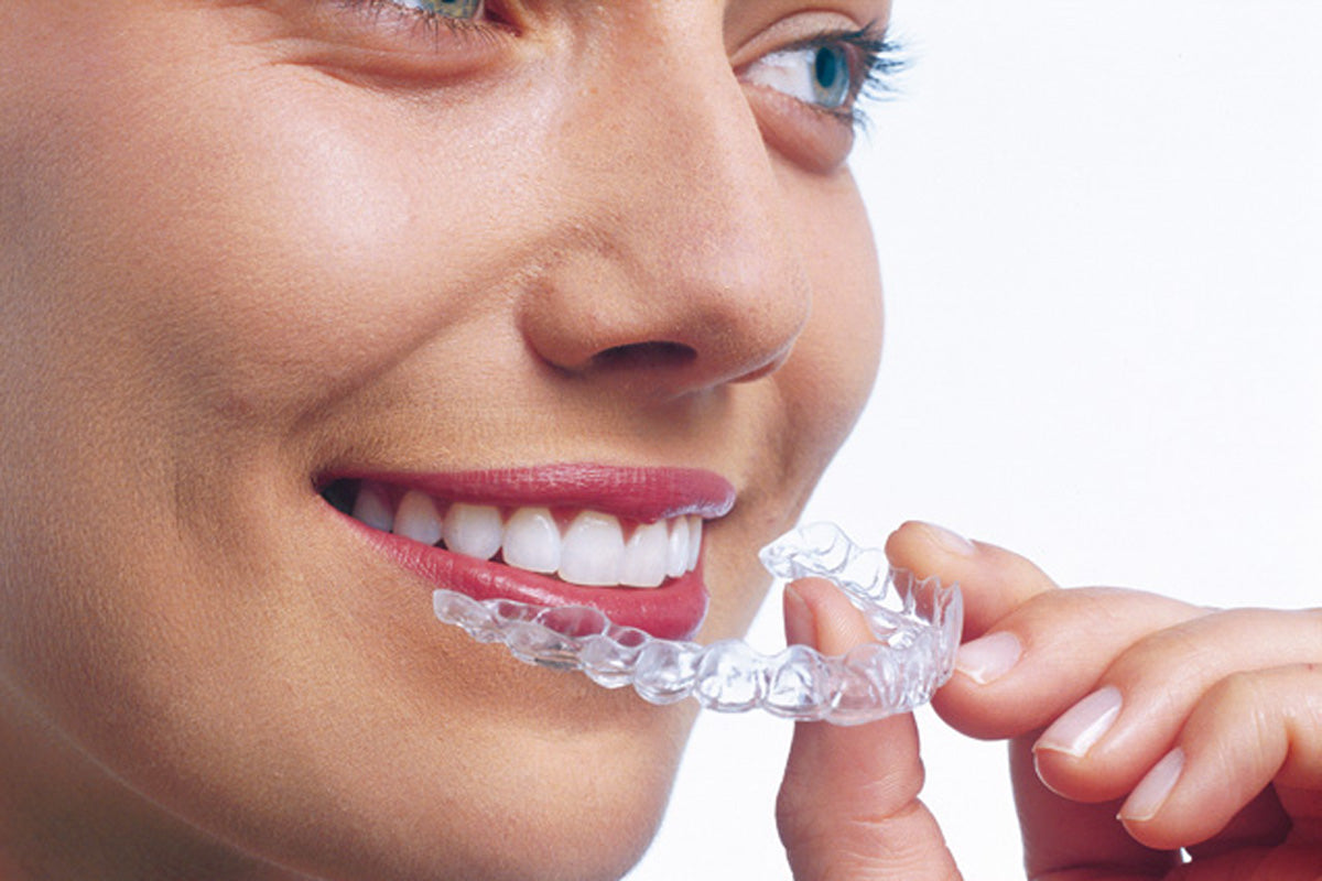 Invisalign Lite – Teeth Straightening for Minor Orthodontic Problems