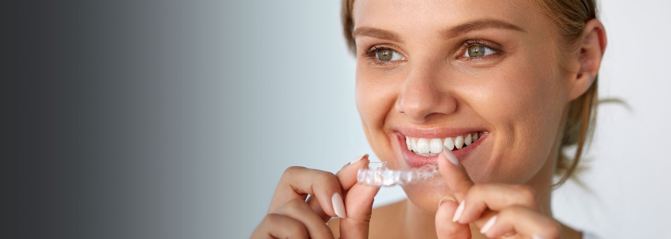 Orthodontic patient with orthodontic aligners
