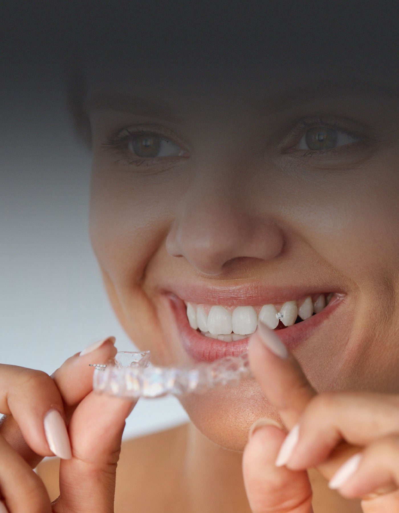 Orthodontic patient with orthodontic aligners